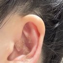 (주)셀비오 | 귀침스티커 셀비오 이어밸런스 귀 지압 패치 비염 후기