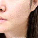 비타메드 | 5분만에 라이브 완판된 화제의 '비타밤'! 이자녹스 비타민c 색소침착 크림 추천 비타민C 42% 비타밤