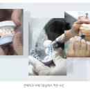 은혜치과기공소 이미지