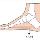 등산 다음날 발바닥 쑤신다면.. '족저근막염' 의심 이미지