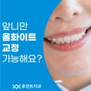 앞니부분교정후기 많은 치과 루센트치과 앞니만 올화이트교정 가능한가요?