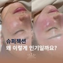 창원 슈퍼젝션 효과 후기 마산 양덕동 영앤뷰티 피부관리