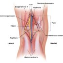 16 - Biceps Femoris 넙다리두갈래근 대퇴이두근(大腿二頭筋) 이미지