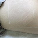 보떼아르 | 강남 튼살전문 보떼슈아, 내돈내산 찐 후기
