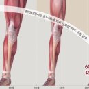 근육본부 이미지