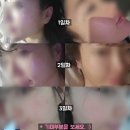 아르케스파-어웨이크닝 리설페이스닝 케어 (트로이필로 아기피부된 후기)