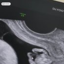 리베 산후조리원 강서점 이미지