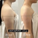 쉼 | [aesthetic] 대전 유성구 마음쉼 에스테틱 웨딩관리 후기