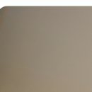 모원성형외과의원 | 신사동성형외과 모발이식 7일 후기, (관리 방법)