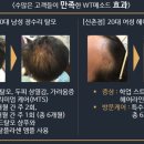 독일WT메소드 이미지