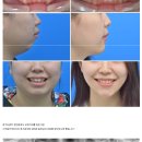 스마일어게인치과교정과치과의원 - 광주시 중앙로 83-6 | 스마일어게인치과교정과치과의원