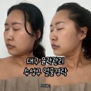 또와 | 대구 수성구 얼굴경락 또와뷰티 윤곽관리 후기