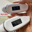 서산 모공 디톡스, 문제성피부 전문 피부 관리 맛집 &#34; 고운피부에스테틱&#34;