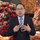 암을 이기려면 꼭, 알아야할 3가지는?-이준원 박사(임상예방의학 전문의, 세포생리학 박사) 이미지