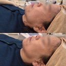 고양동산고등학교 | 고양 삼송 뷰티샵 뷰티몬드 피부기기관리 후기