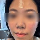 남포동에스테틱 살롱드비숑 중앙점 플라모드 관리로 리프팅 제대로
