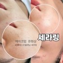 안산 피부관리 보라뷰띠끄 재방문 후기