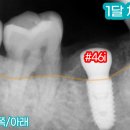 행운동-44 네이버블로그