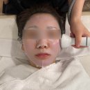 합정피부관리 | 마이디스킨랩, 예비신부 엑소좀 관리 본식 일주일전 관리 후기