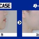 예쁜미소치과교정과치과의원 이미지