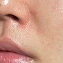 우신반점 | 주름 없애는 법으로 주목받는 주름 패치! 실제로도 효과가 있을까? ‘라보타치 미간 케어 패치’ 사용후기