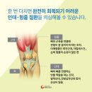 힘줄 이미지