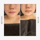 군산 윤곽관리 수송동 루아에스테틱 K홀리스틱 방짜유기봉 후기