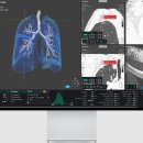 코어소프트 이미지