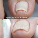 네일조아 이미지