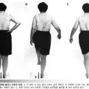 mis-10 요추의 운동손상 증후군 이미지