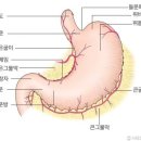 만성 위축성위염 이미지