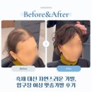 대신자연에너지 | 흑채 대신 자연스러운 가발, 압구정 여성 맞춤가발 후기