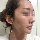제산한의원 | 리유한의원 신사점에서 효과 봐서 비용 안 아까워용ㅎㅎ