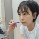 울쎄라 후 통증 울쎄라피프라임 300샷 수면마취 없이 받은 후기