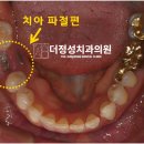 정성치과기공소 이미지