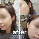 듀얼인터넷 | 스타클 기술 담은 피부관리 홈케어 《니딥 피디알엔 리뉴 스타샷 500 듀얼 솔루션》 사용 후기