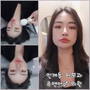U&I(유앤아이) | 초입 피부시술 잘하는 곳 수원시청역 8번 출구 유앤아이 의원 U&amp;I 피부과 수원 인계점 보톡스 시술 후기
