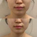 행복중심용산생협 | [결혼준비] 빛으나 용산점 | 용산 에스테틱 | 용산 피부관리 | 용산 윤곽관리 | 맞춤 웨딩관리 후기