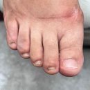 문제성 손, 발 오감네일 | 인천 도화동 문제성 손 발 오감네일 도화점 방문 후기