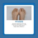 고양정형외과 네이버블로그