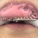 서울윌치과 이미지