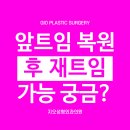 앞트임 복원 후 재트임 눈모양 조절 가능할까요? 이미지