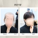세종충대병원 항암 치료 중,자연스러운 항암가발 찾는다면? 위그갤러리 방문 후기