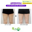 톡스미의원