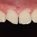 테크노파크역1-2 이미지