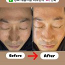 돋보이 개 | 화장 안 먹고 자꾸 붉어지는 피부.. 원인은 “이거”부족이더라고요