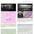 Spinal tumor가 있는 18마리의 개와 1마리의 고양이에서의 MRI 특징과 수술 예후에 대해 다룬 논문 이미지