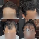 살롱포맨 | 탈모커버펌을 하려고 광명에서 금천구 쇼군헤어포맨을 방문하는 이유(feat.리뷰와후기)