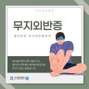 김포관절병원, 여름철 발의 고민 무지외반증 이미지