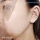이은특허 | 마스크팩 추천 헉슬리 바이오시스 360 겔 마스크 내돈내산 후기